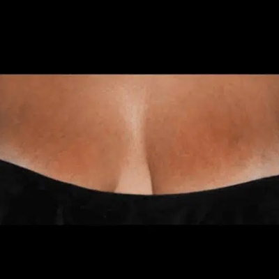 Park Ave Derm-Resurfx 4